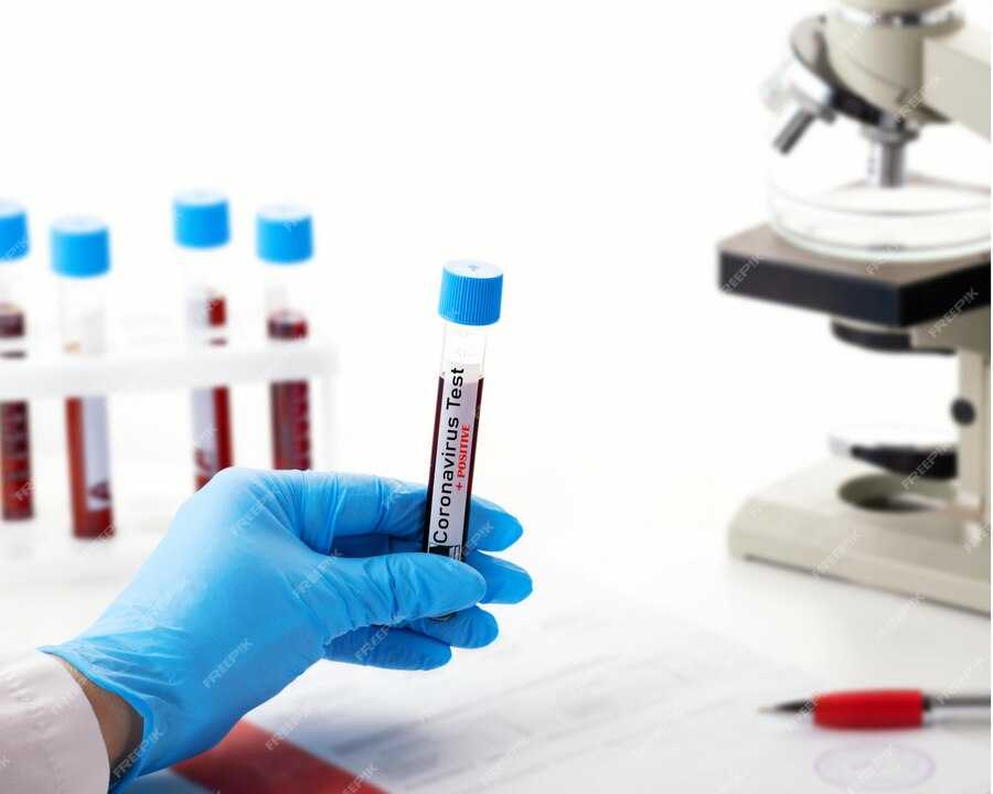 Beta HCG Free and Total Serum