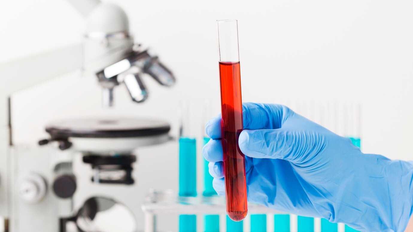 Mantoux screening Test